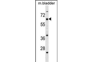 CECR6 Antibody (C-term) (ABIN1537417 and ABIN2849405) western blot analysis in mouse bladder tissue lysates (35 μg/lane). (CECR6 antibody  (C-Term))
