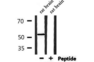 Western blot analysis of extracts from rat brain, using KAPCB Antibody. (PRKACB antibody  (C-Term))