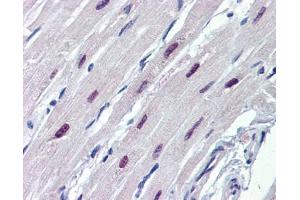 Human Heart (SOX4 antibody  (N-Term))