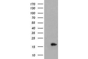 Image no. 1 for anti-Cellular Retinoic Acid Binding Protein 2 (CRABP2) antibody (ABIN1497621) (CRABP2 antibody)