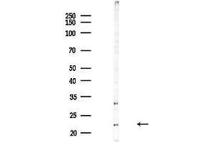 Western blot analysis of lysates from COLO205 cells(heat-shock,45 min treatment), using TME Antibody at 1/1000 dilution.