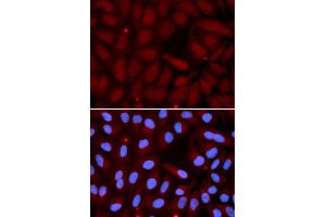 Immunofluorescence (IF) image for anti-Surfactant Protein C (SFTPC) antibody (ABIN1874760) (Surfactant Protein C antibody)