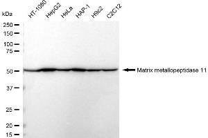 Western blotting analysis using Matrix metallopeptidase 11 antibody (ABIN7799338).