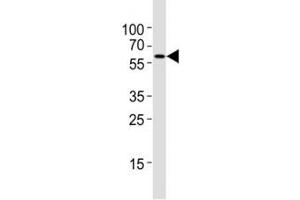 Western blot testing of Atg5 antibody at 1:4000 dilution + NIH3T3 lysate (ATG5 antibody  (AA 167-199))