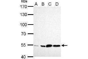 WB Image ALDH2 antibody detects ALDH2 protein by Western blot analysis. (ALDH2 antibody  (Center))