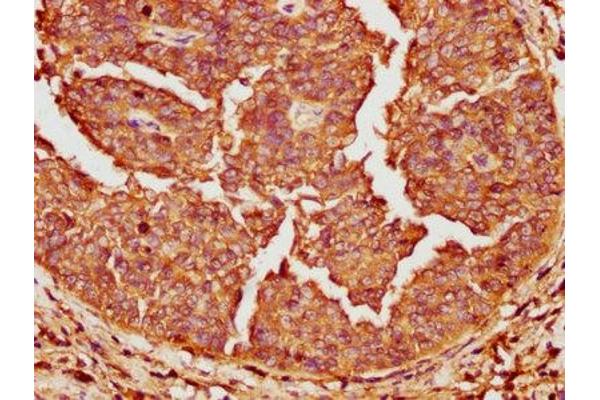 ERAP2 antibody  (AA 406-522)
