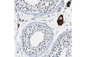 Immunohistochemical staining of human testis with LOC203547 polyclonal antibody  shows strong cytoplasmic positivity in Leydig cells. (VMA21 antibody)