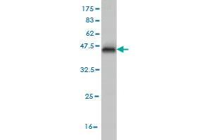 Western Blot detection against Immunogen (37. (ETV1 antibody  (AA 148-257))