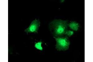 Anti-DTYMK mouse monoclonal antibody (ABIN2454996) immunofluorescent staining of COS7 cells transiently transfected by pCMV6-ENTRY DTYMK (RC201228). (DTYMK antibody)