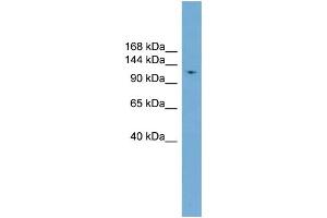 WB Suggested Anti-LIG1  Antibody Titration: 0. (LIG1 antibody  (Middle Region))
