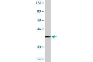 Western Blot detection against Immunogen (37. (SAMD4A antibody  (AA 161-270))