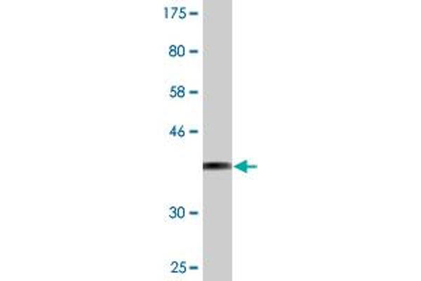 SAMD4A antibody  (AA 161-270)