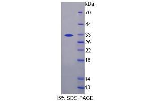 Image no. 1 for Pregnancy Zone Protein (PZP) (AA 1246-1495) protein (His tag) (ABIN4990536) (PZP Protein (AA 1246-1495) (His tag))