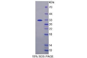 Image no. 1 for Pregnancy Zone Protein (PZP) (AA 1246-1495) protein (His tag) (ABIN6238590)