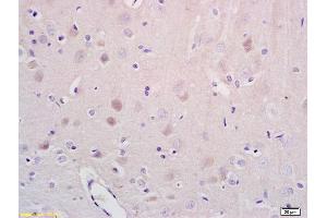Immunohistochemistry (IHC) image for anti-Nuclear Receptor Subfamily 1, Group D, Member 1 (NR1D1) antibody (ABIN700854)