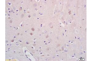 Formalin-fixed and paraffin embedded rat brain tissue labeled with Anti-NR1D1/REV-ERB alpha Polyclonal Antibody, Unconjugated (ABIN700854) at 1:200 followed by conjugation to the secondary antibody and DAB staining (NR1D1 antibody)