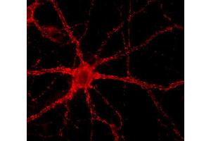 Immunocytochemistry on cultured hippocampus neurons (dilution 1 : 1000) (VAMP2 antibody  (AA 2-17))