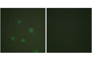 Immunofluorescence analysis of A549 cells, using Progesterone Receptor (Ab-400) Antibody. (Progesterone Receptor antibody  (AA 371-420))