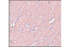 Immunohistochemistry of SYNGR3 in rat brain tissue with this product at 2. (Synaptogyrin 3 antibody  (C-Term))