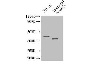 Western Blot Positive WB detected in: Mouse brain tissue, Mouse skeletal muscle tissue All lanes: SEPP1 antibody at 4 μg/mL Secondary Goat polyclonal to rabbit IgG at 1/50000 dilution Predicted band size: 43 kDa Observed band size: 43, 40 kDa (Selenoprotein P (SELENOP) (AA 20-381) antibody)