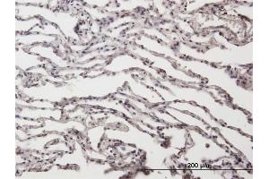 Immunoperoxidase of purified MaxPab antibody to ADAR on formalin-fixed paraffin-embedded human lung. (ADAR antibody  (AA 1-1226))