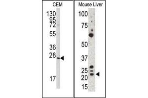 Image no. 1 for anti-Gremlin 1 (GREM1) (C-Term) antibody (ABIN358612) (GREM1 antibody  (C-Term))