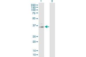 Western Blotting (WB) image for anti-Protein Kinase, CGMP-Dependent, Type I (PRKG1) (AA 1-312) antibody (ABIN519212)