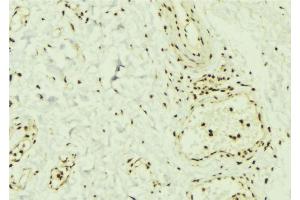 ABIN6269369 at 1/100 staining Mouse muscle tissue by IHC-P.