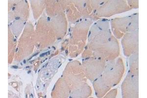 Detection of CD74 in Mouse Skeletal muscle Tissue using Polyclonal Antibody to Cluster Of Differentiation 74 (CD74) (CD74 antibody  (AA 64-205))