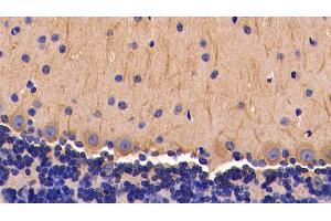 Detection of TNFa in Mouse Cerebellum Tissue using Polyclonal Antibody to Tumor Necrosis Factor Alpha (TNFa) (TNF alpha antibody  (AA 80-235))