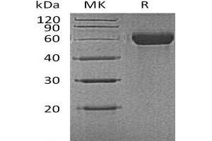 Western Blotting (WB) image for Macrophage Receptor with Collagenous Structure (MARCO) protein (His tag) (ABIN7320802)