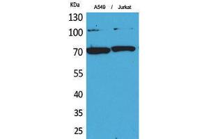 Western Blotting (WB) image for anti-X-Ray Repair Complementing Defective Repair in Chinese Hamster Cells 6 (XRCC6) (Ser403) antibody (ABIN3178361) (XRCC6 antibody  (Ser403))