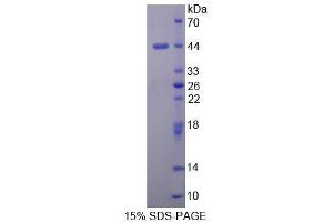 SDS-PAGE (SDS) image for Cerebral Dopamine Neurotrophic Factor (CDNF) (AA 33-187) protein (His tag,GST tag) (ABIN2122597) (CDNF Protein (AA 33-187) (His tag,GST tag))