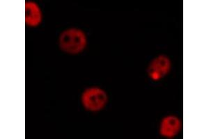 Immunofluorescence (fixed cells) (IF/ICC) image for anti-Mdm2, p53 E3 Ubiquitin Protein Ligase Homolog (Mouse) (MDM2) antibody (ABIN6263177)