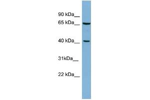 WB Suggested Anti-POLB Antibody Titration: 0. (POLB antibody  (Middle Region))
