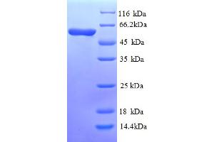 SDS-PAGE (SDS) image for Cystathionine-beta-Synthase (CBS) (AA 1-507), (full length) protein (His tag) (ABIN4977080) (CBS Protein (AA 1-507, full length) (His tag))