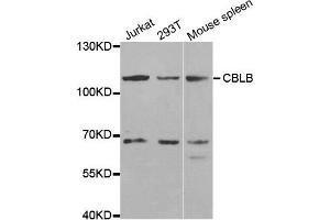 Western blot analysis of extracts of various cell lines, using CBLB antibody. (Cbl Proto-Oncogene B, E3 Ubiquitin Protein Ligase (CBLB) antibody)
