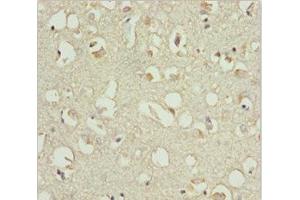 Immunohistochemistry of paraffin-embedded human brain tissue using ABIN7151541 at dilution of 1:100 (EEF1B2 antibody  (AA 1-225))