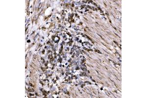 IHC analysis of KLF15 using anti-KLF15 antibody (ABIN7599269). (KLF15 antibody  (AA 1-323))