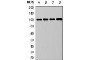 Western blot analysis of CD10 expression in Raji (A), MCF7 (B), mouse kidney (C), mouse liver (D) whole cell lysates.