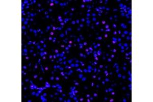 Immunofluorescent analysis of paraformaldehyde-fixed rat kidney using ADRA1B (ABIN7072974) at dilution of 1: 1200 (ADRA1B antibody)