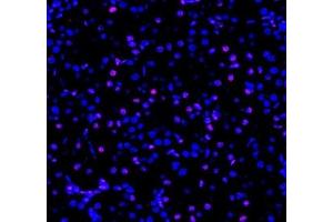 Immunofluorescent analysis of paraformaldehyde-fixed rat kidney using ADRA1B (ABIN7072974) at dilution of 1: 1200 (ADRA1B antibody)