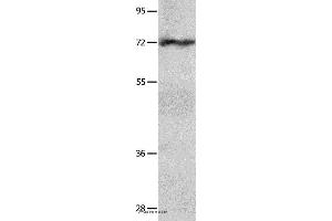 Western blot analysis of Hela cell  , using IGF2BP1 Polyclonal Antibody at dilution of 1:750 (IGF2BP1 antibody)