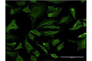 Immunofluorescence of monoclonal antibody to AKT1 on HeLa cell. (AKT1 antibody  (AA 127-200))