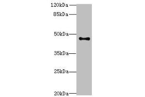 Western blot analysis of PC-3 whole cell lysates, using AADACL2 antibody (2 μg/ml) and Goat anti-Rabbit polyclonal secondary antibody (1/10000 dilution). (AADACL2 antibody  (AA 181-379))