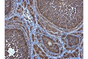 IHC-P Image ATG4D antibody [N3C3] detects ATG4D protein at cytoplasm in mouse ovary by immunohistochemical analysis. (ATG4D antibody  (Center))