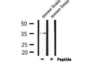 Western blot analysis of extracts from mouse brain, using Olfactory receptor 5AP2 Antibody. (OR5AP2 antibody)
