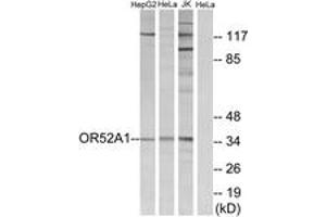 Western Blotting (WB) image for anti-Olfactory Receptor, Family 52, Subfamily A, Member 1 (OR52A1) (AA 20-69) antibody (ABIN2891124)