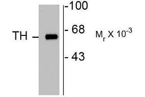 Image no. 1 for anti-Tyrosine Hydroxylase (TH) antibody (ABIN372734) (Tyrosine Hydroxylase antibody)