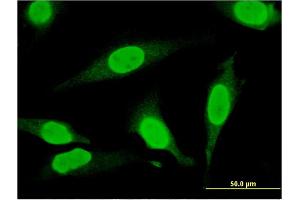 Immunofluorescence of monoclonal antibody to THAP11 on HeLa cell. (THAP11 antibody  (AA 1-85))